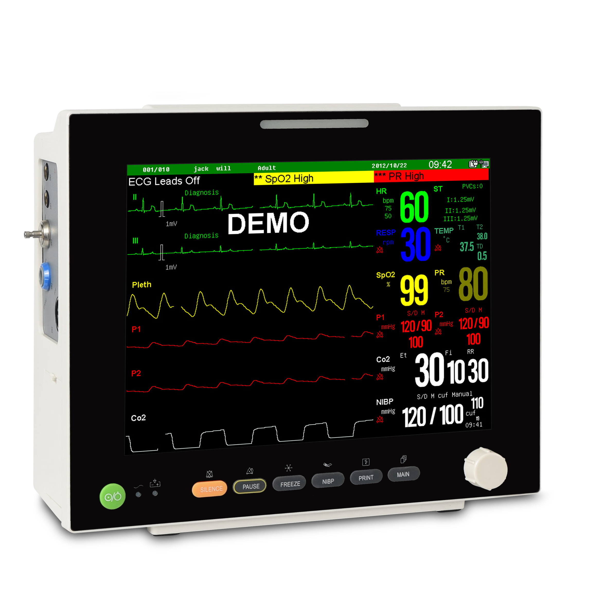 Standard Multi-Parameter Patient Monitor