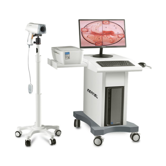 Digital Colposcope Imaging System