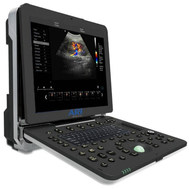 New General Portable Ultrasound Scanner