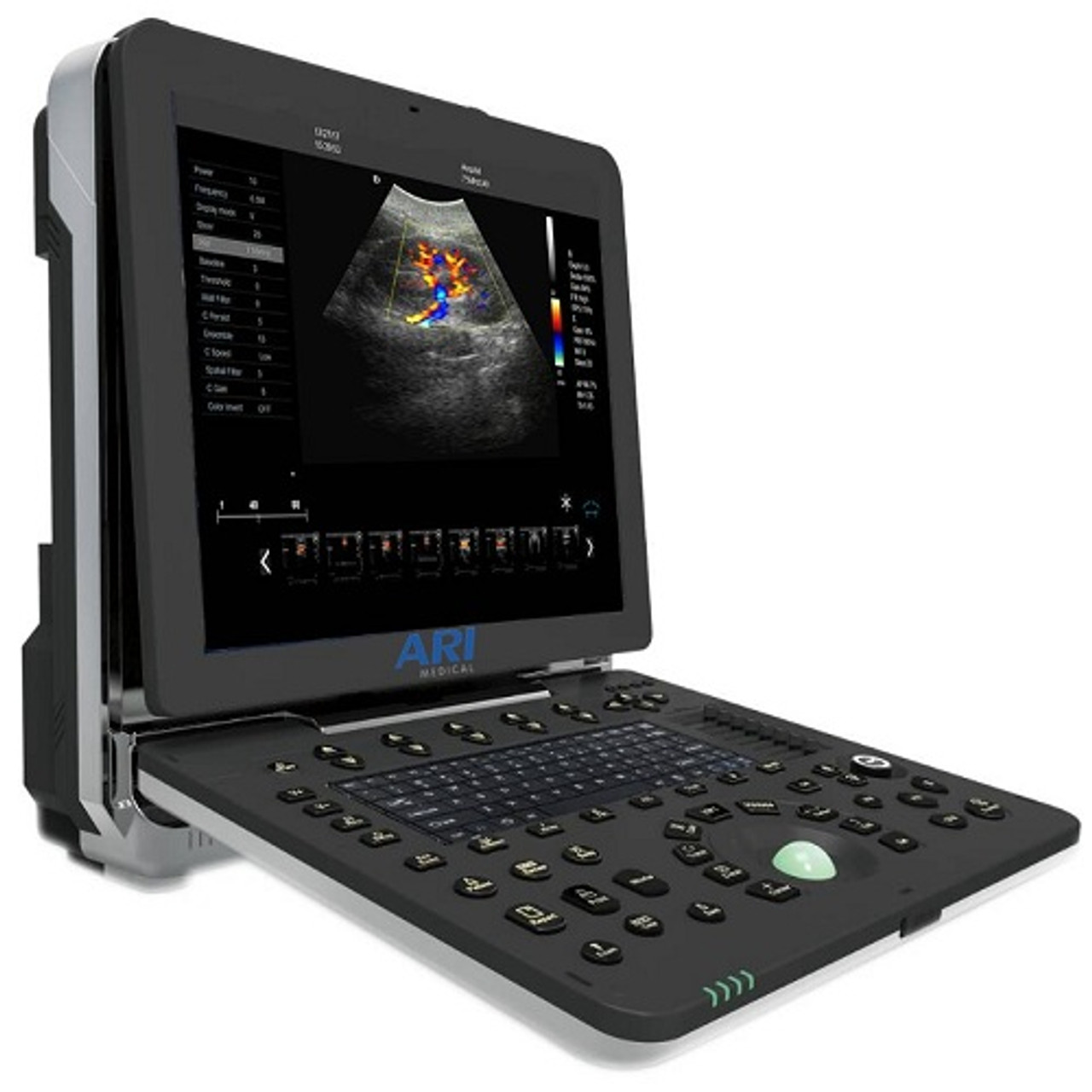 New General Portable Ultrasound Scanner