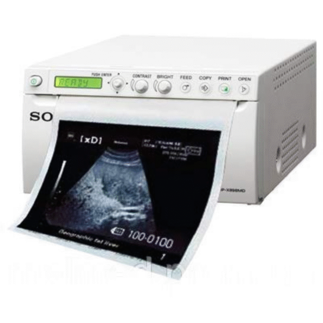 Ultrasound Printer